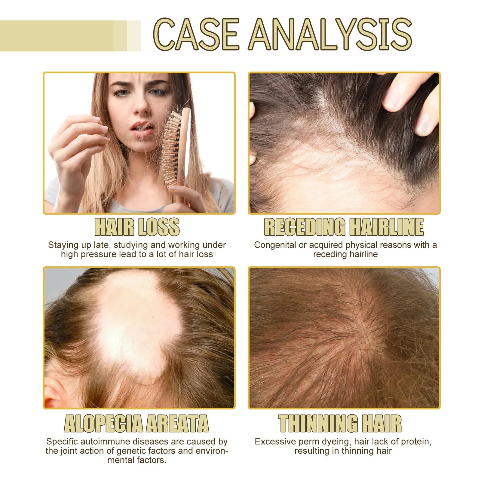 EELHOE Rosemary Oil Grows Hair Loss Treatment Bald Head Hair Regrowth Moisturizing Hair Scalp Massager Rosemary Essential Oil